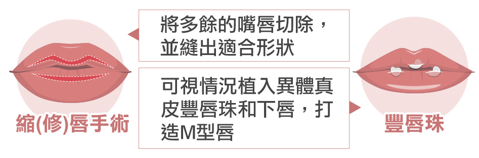 縮唇手術, 修唇, M型唇, 豐唇珠