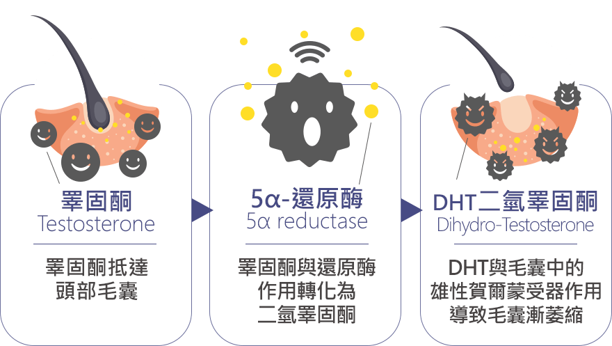 落髮原因:雄性禿原因