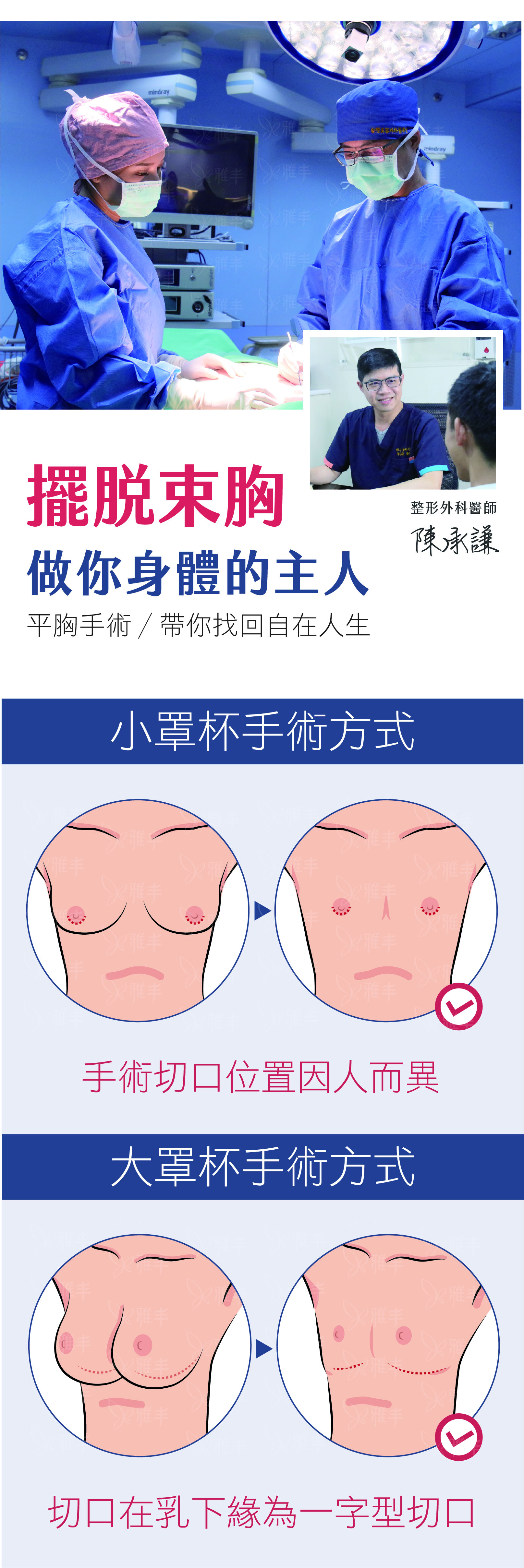 平胸手術,女同志手術,縮乳,縮胸