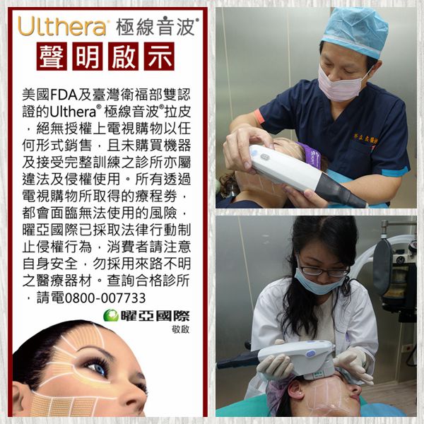 Ulthera極線音波拉皮施打中