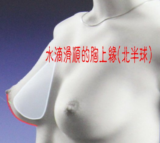 水滴型隆乳蜜桃絨果凍