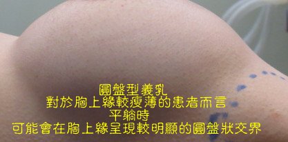 水滴型隆乳蜜桃絨果凍