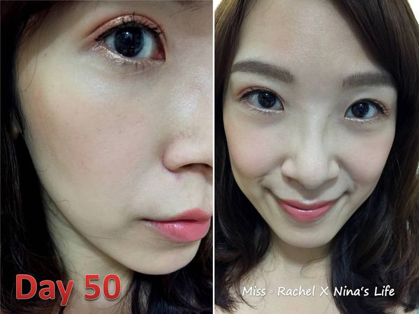 部落客縫雙眼皮眼袋內開術後第50天化妝,吳欣恆醫師