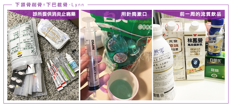 Lynn削骨下巴截骨術後第1天照護