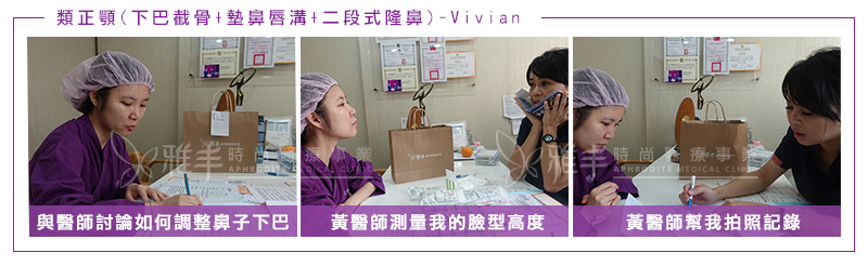 VIVIAN隆鼻墊鼻唇溝下巴截骨手術當天