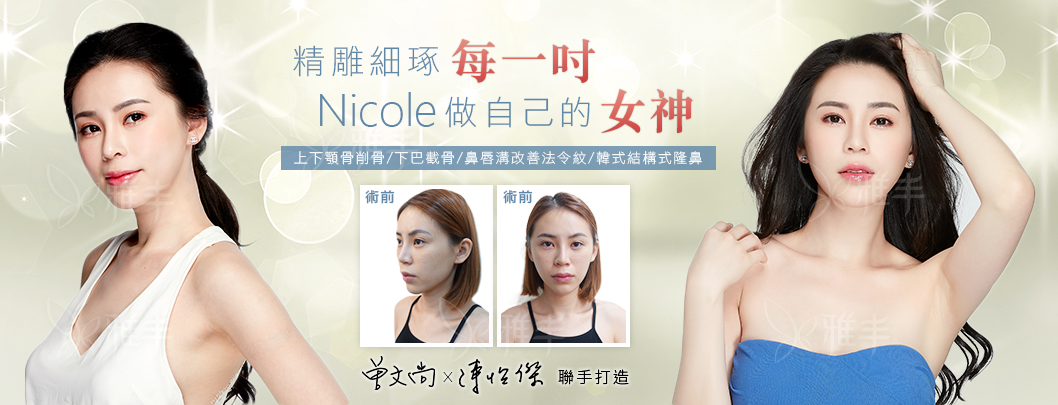 nicole削骨下巴法令紋手術全臉精雕細琢,雅丰陳怡傑