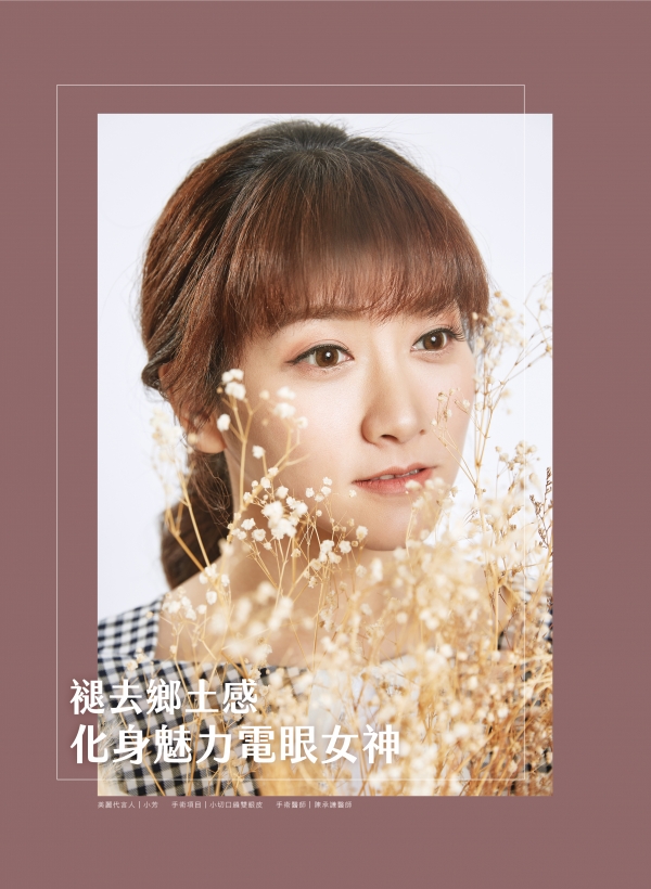 78期美人誌｜陳承謙雙眼皮案例1