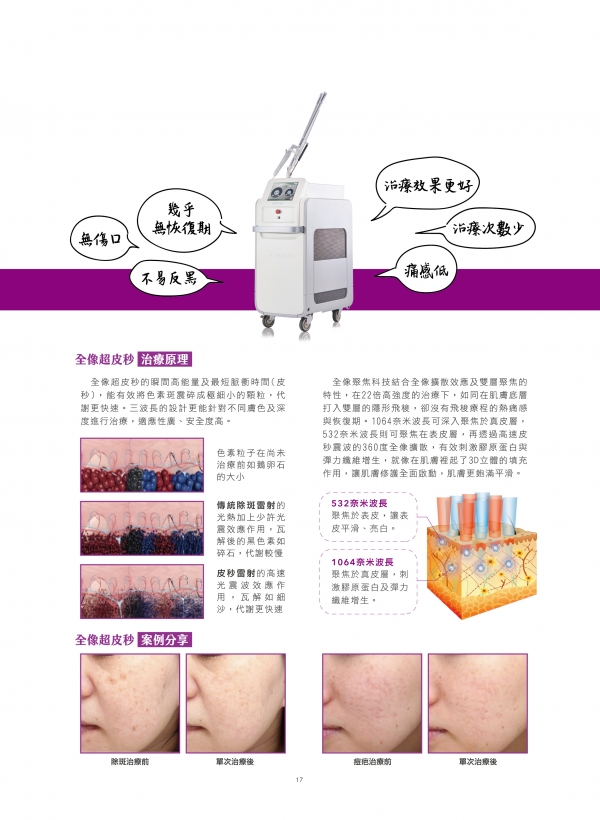 雅丰美人誌79期｜Picoway全像超皮秒2