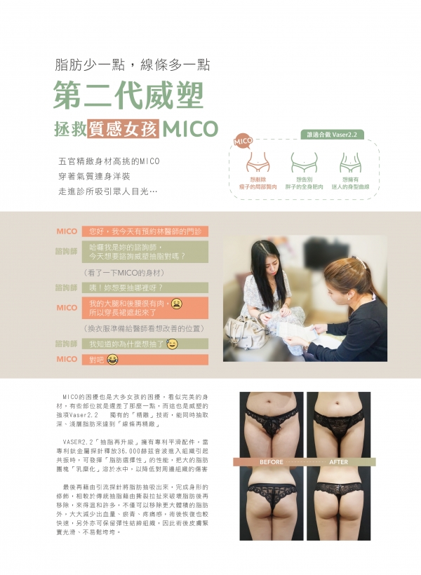 雅丰美人誌80期｜林孟羲醫師-第二代威塑抽脂案例1