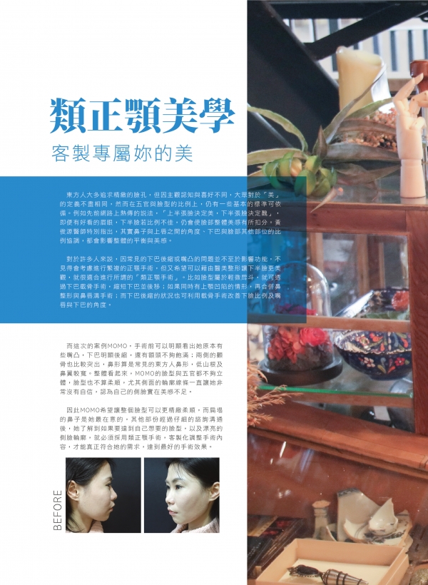 雅丰美人誌81期｜黃俊源醫師-類正顎手術案例1