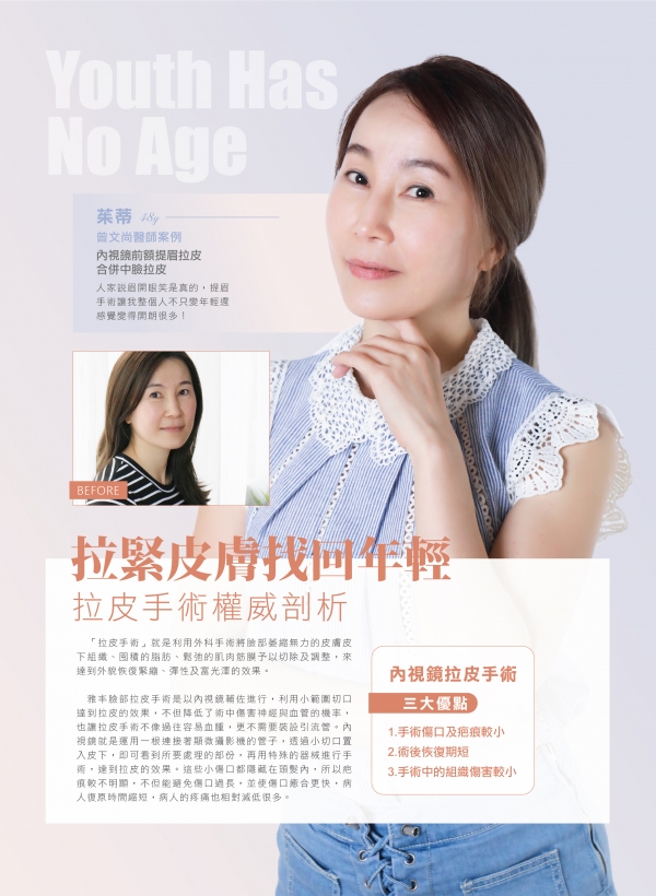 雅丰美人誌81期｜曾文尚醫師-內視鏡臉部拉皮案例1
