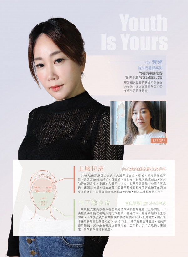 雅丰美人誌81期｜曾文尚醫師-內視鏡臉部拉皮案例2