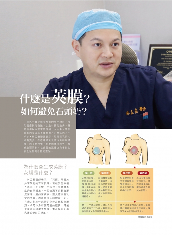 雅丰美人誌81期｜林孟羲醫師-什麼是莢膜?如何避免石頭奶1