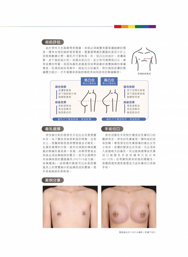 雅丰美人誌81期｜張松源醫師-跨界性感，男性隆乳手術2