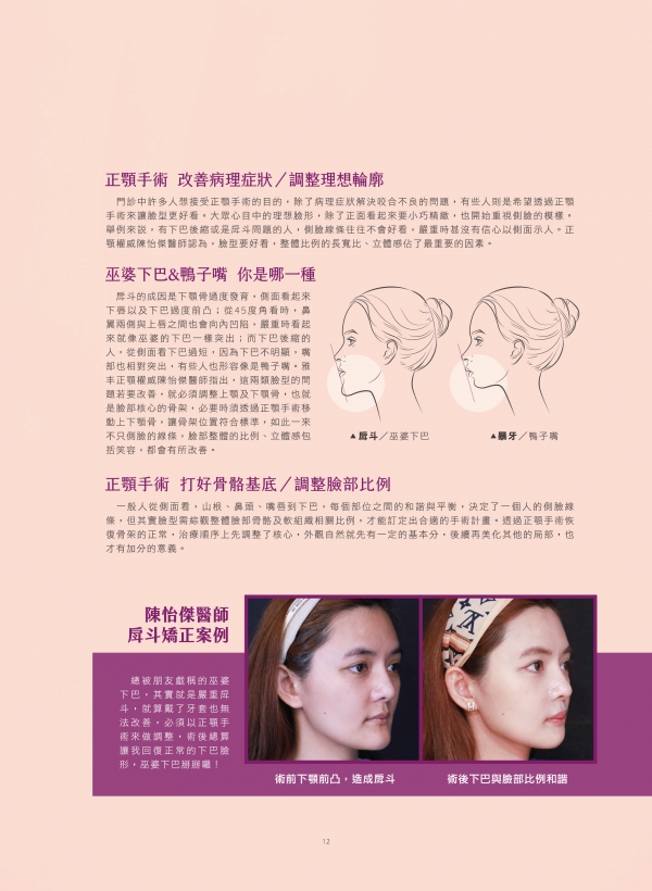 雅丰美人誌82期｜陳怡傑醫師-正顎手術針對性根治巫婆下巴2
