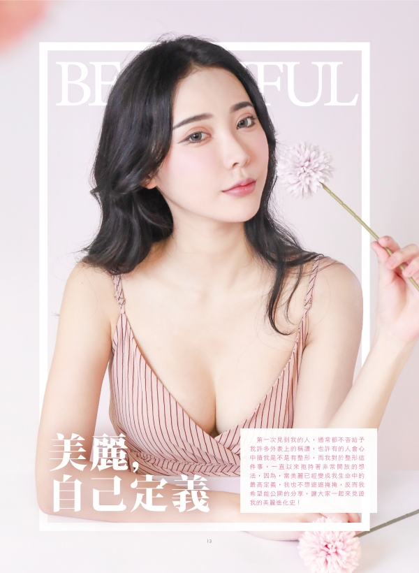 雅丰美人誌82期｜張松源、黃俊源醫師-雙眼皮、結構式隆鼻、MOTIVA案例1