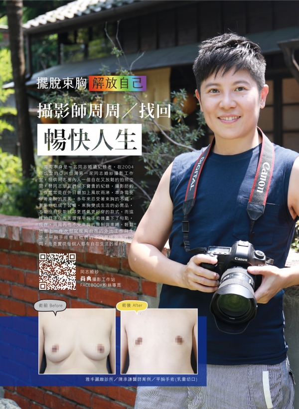 雅丰美人誌82期｜陳承謙醫師-平胸手術案例1