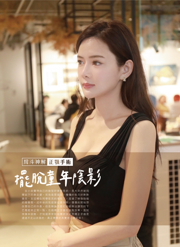 雅丰美人誌84期｜陳怡傑醫師-正顎手術案例1