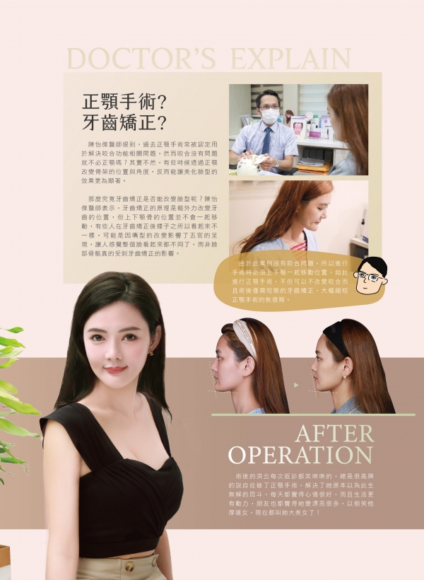 雅丰美人誌84期｜陳怡傑醫師-正顎手術案例2