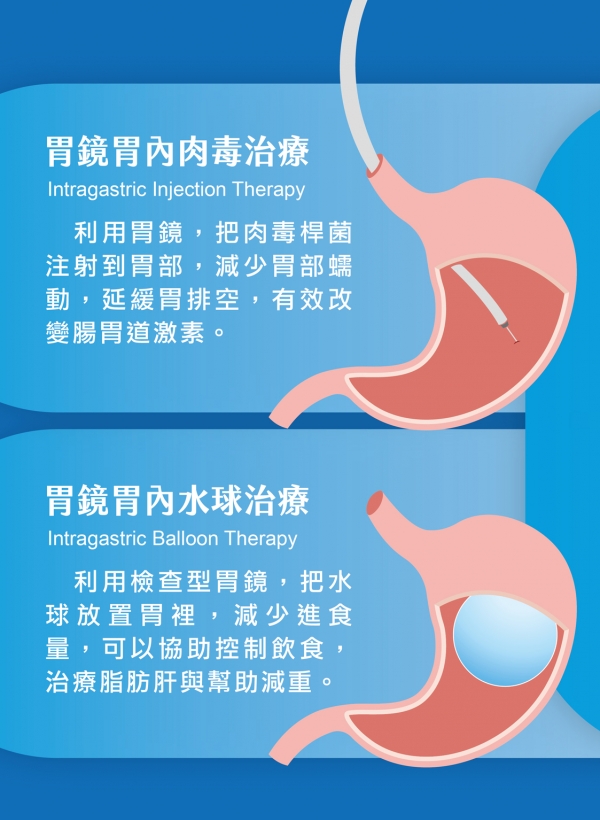 雅丰美人誌85期｜肥胖治療新領域—胃鏡減重治療3