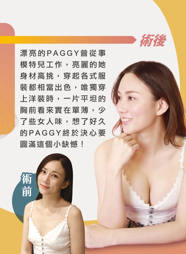 雅丰美人誌86期｜Motiva隆乳，為妳添加胸前性感值2