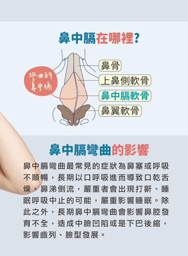 雅丰美人誌86期｜什麼是「鼻中膈彎曲」2