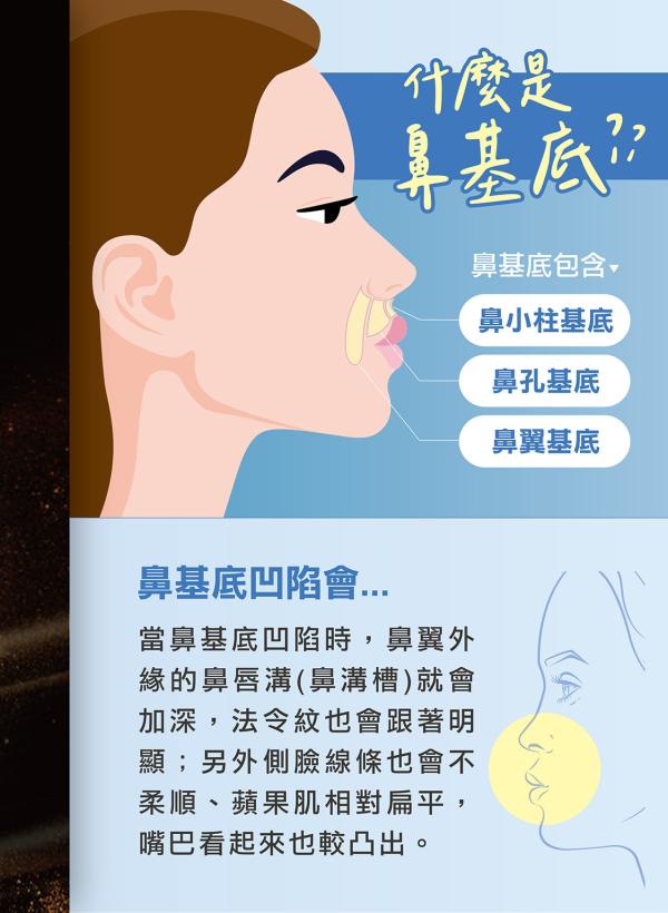 雅丰美人誌87期｜什麼是鼻基底？該怎麼改善鼻基底凹陷？