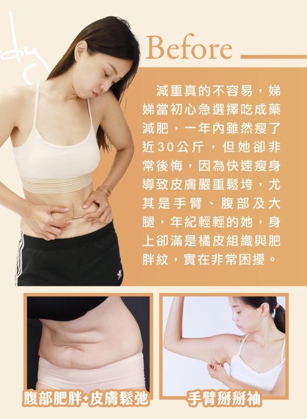 雅丰美人誌88期｜重塑身型打造完美體態，美麗代言人娣娣3