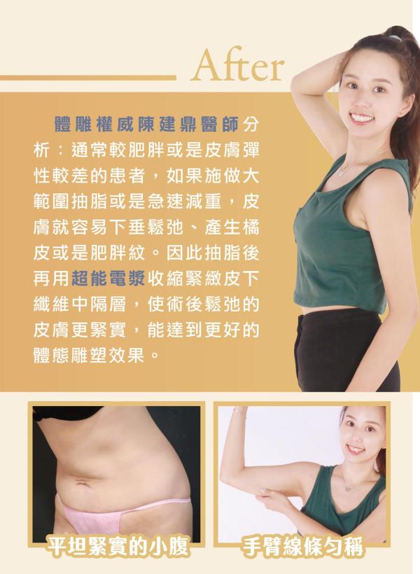 雅丰美人誌88期｜重塑身型打造完美體態，美麗代言人娣娣4