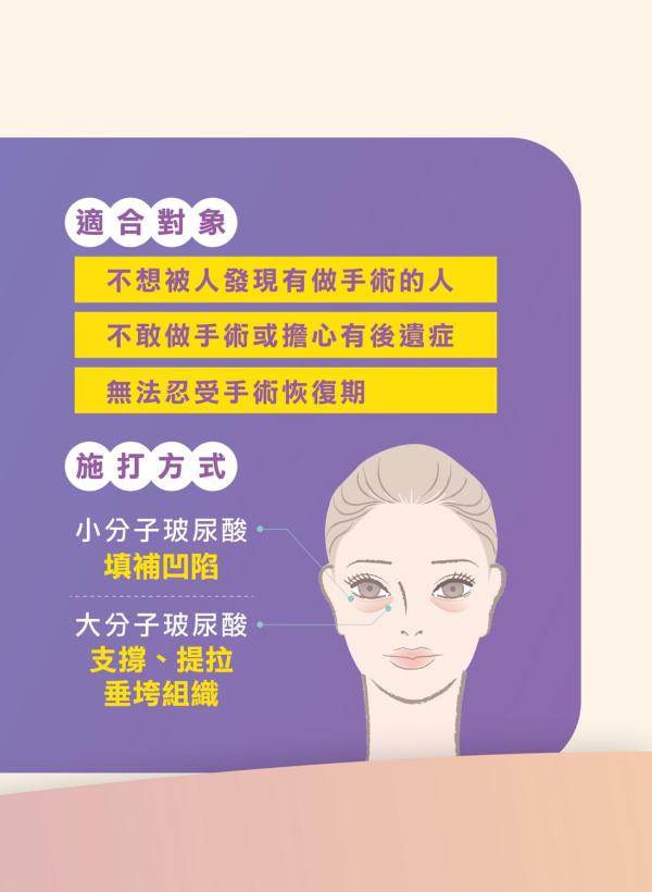 雅丰美人誌88期｜多層次隱形眼袋注射，消除眼袋SO EASY4