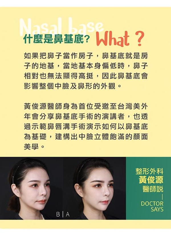 雅丰美人誌89期｜打造貴婦氣場從鼻基底開始03