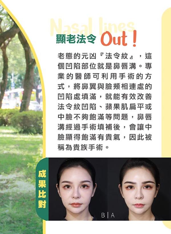 雅丰美人誌89期｜打造貴婦氣場從鼻基底開始02