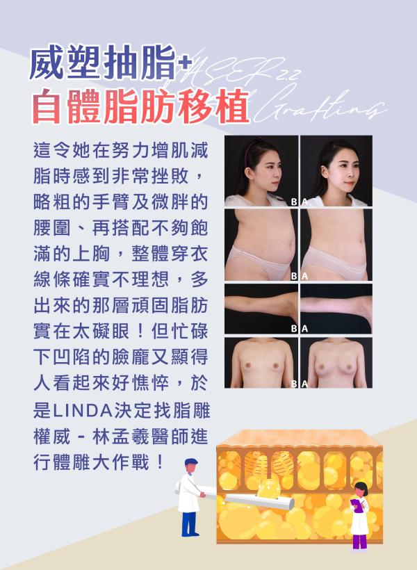 雅丰美人誌90期｜脂雕美學 脂肪大挪移