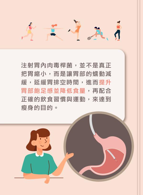 no92_胃肉毒