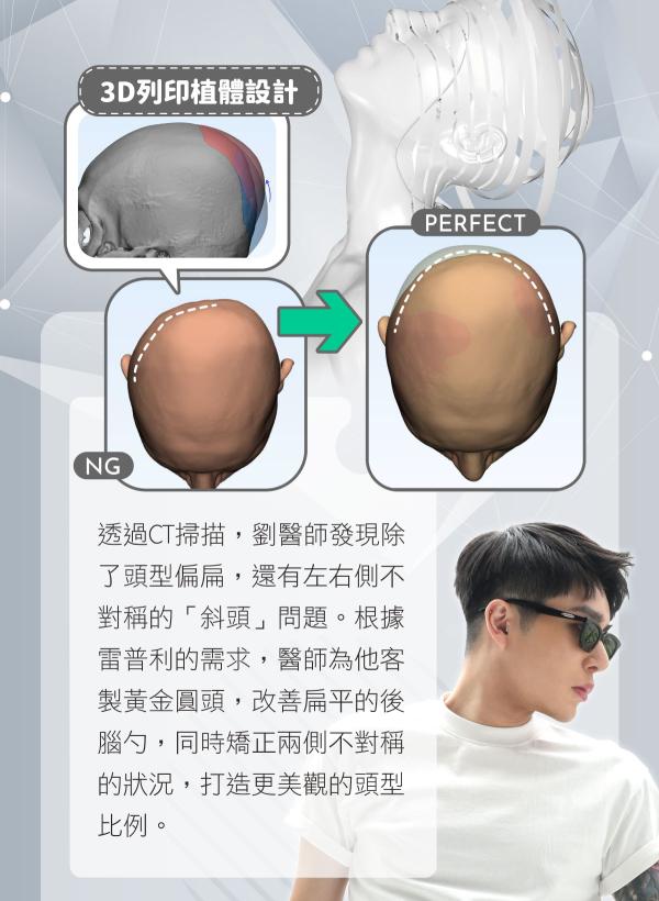 no97-美麗代言人_3D列印雷普利_3.jpg