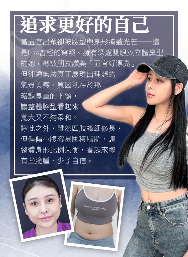 美麗代言人_美麗見證_Lisa_第三代削骨_腰腹環抽_超能電漿_林孟羲醫師_余宗宸醫師_02