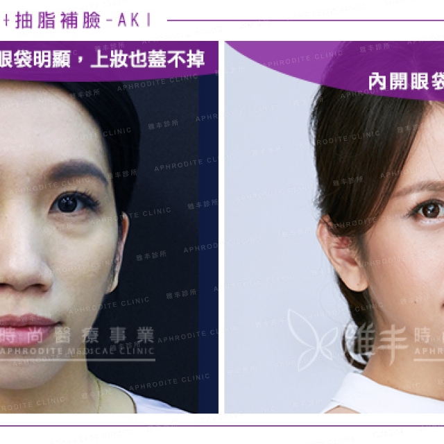 1051104_aki_08.jpg