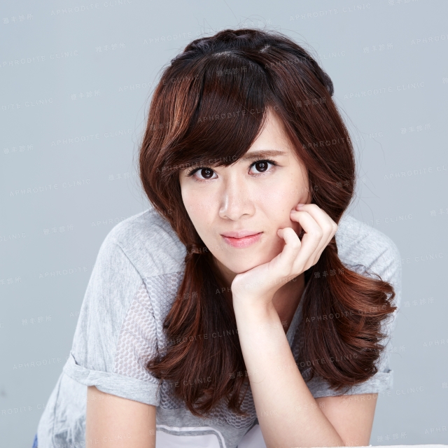 眼袋手術 縫雙眼皮 雅丰診所案例婷婷