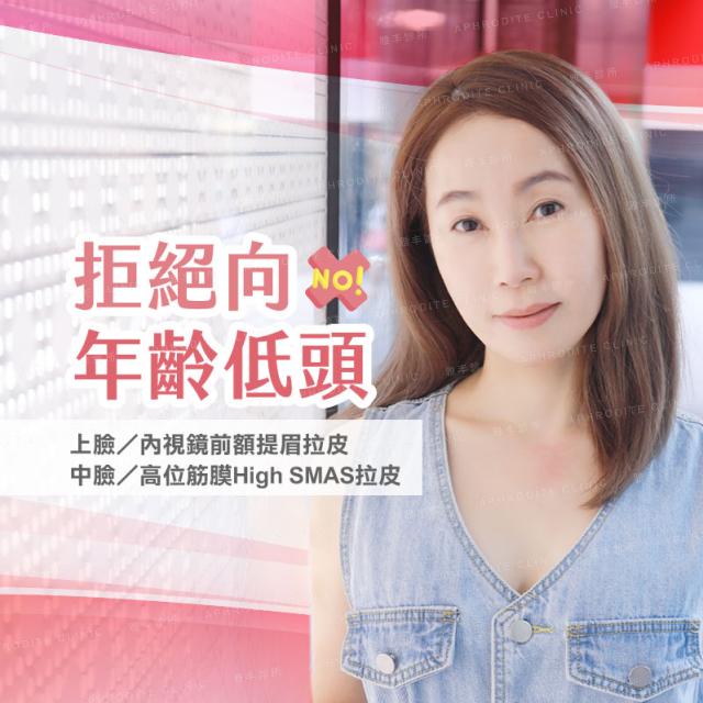 拉皮手術 上臉拉皮 雅丰拉皮案例 魚姊