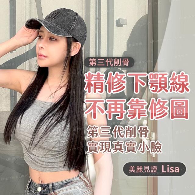 方臉女孩蛻變！變身精緻瓜子臉