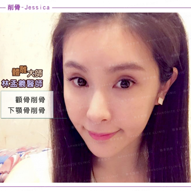 albeejheng_bone1_0.jpg