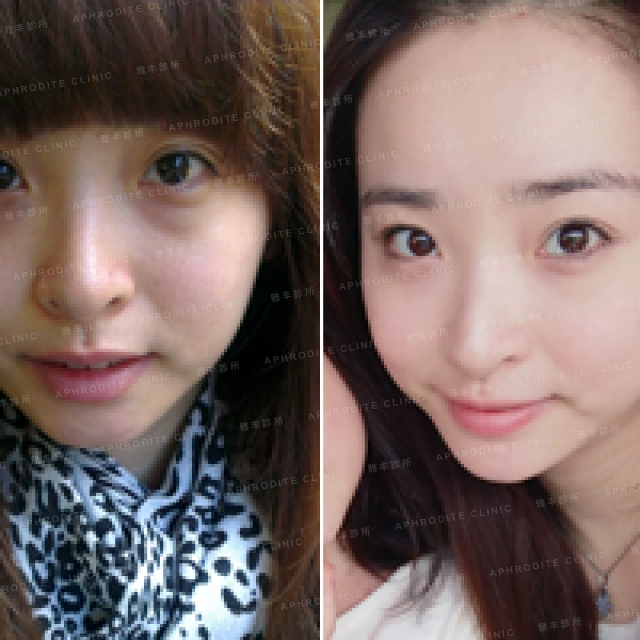 beauty_susan-eye bags0000s.jpg