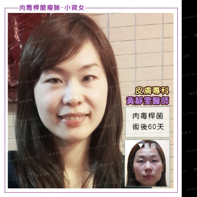 cll_face_00.jpg