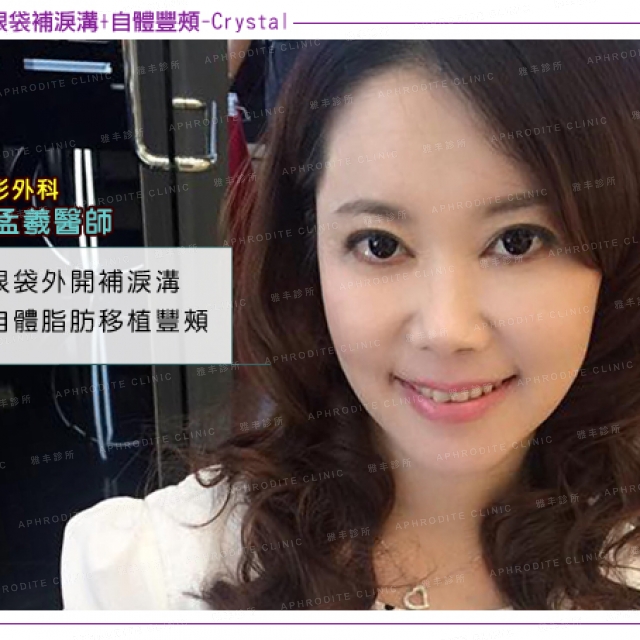 crystal_face01.jpg