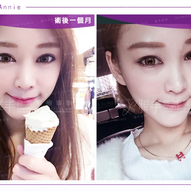 fatgraft_annie_10.jpg