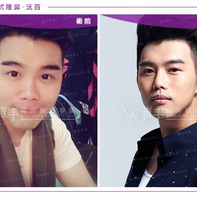 knose_case_yuanbai_08.jpg