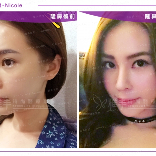 nicoleNOSE_07.jpg