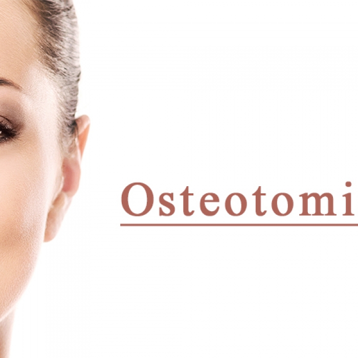 Osteotomies01.jpg