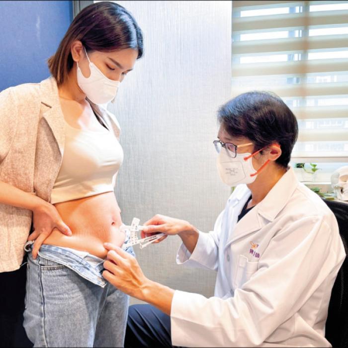 【自由健康網】產後別急著減肥 經期穩定再甩肉│整形外科陳建鼎醫師