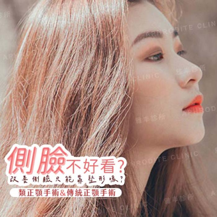 側臉不好看?改善側臉只能靠整形嗎? │雅丰診所